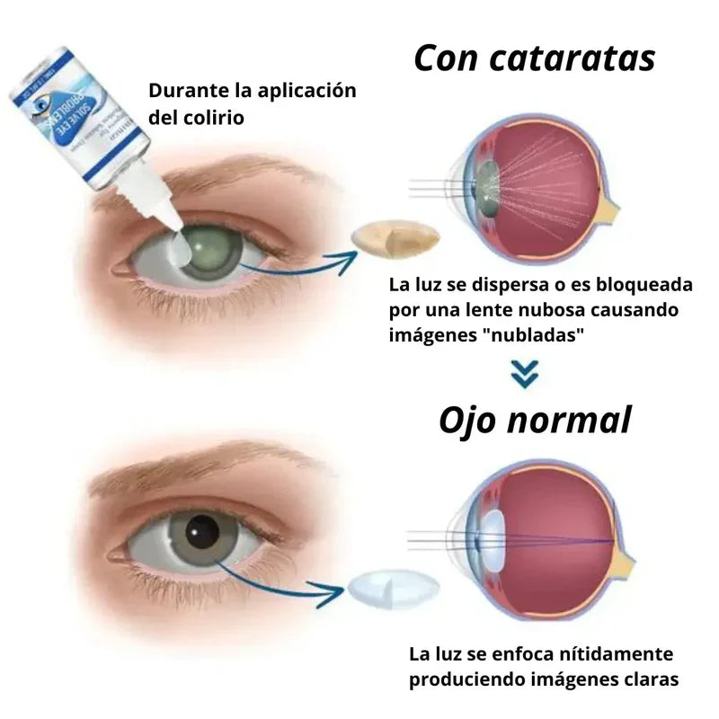 GOTAS OFTÁLMICAS MILAGROSAS PARA PROBLEMAS DE OJOS