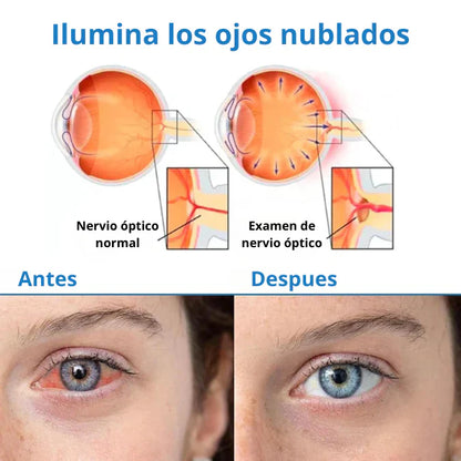 GOTAS OFTÁLMICAS MILAGROSAS PARA PROBLEMAS DE OJOS